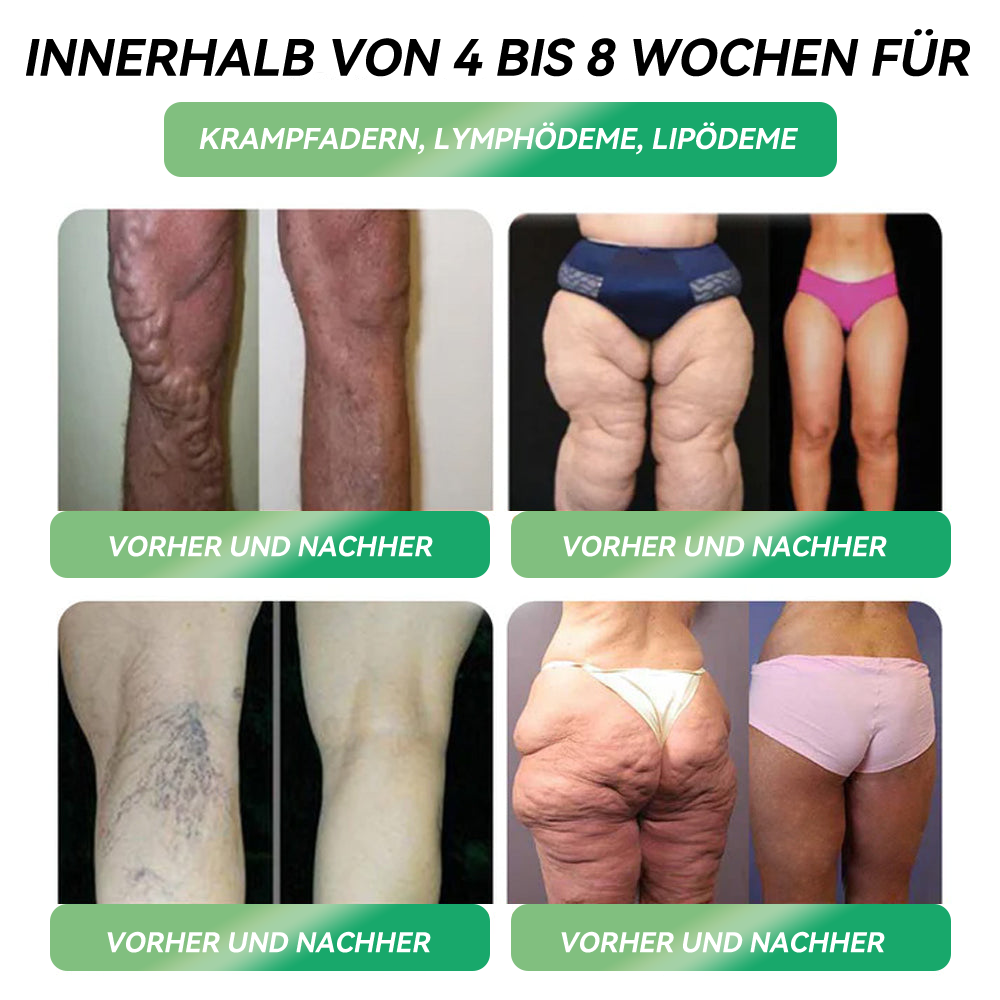Genieße 30 % Rabatt beim Hinzufügen des zweiten Artikels 🧡