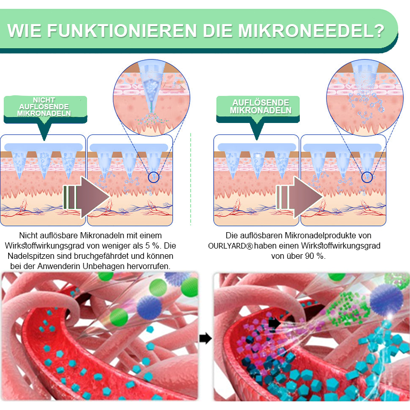 【Letzter Tag – 60 % RABATT 💓】Ourlyard® NIDDK-Tirzepatid Schlankheits- & Gesundheits-NANO-MIKRONEDEL-PFLASTER 🇩🇪 (Kein Schmerz, 24/7 Wirkstofffreisetzung | Schnell 9 kg verlieren | 90 % Blutzuckersenkung) 🐅🏹